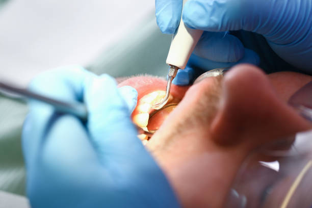 Best Cracked Tooth Emergency Dentist  in Reston, VA