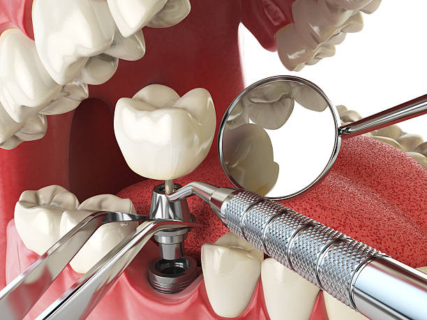 Best Tooth Pain Emergency Relief  in Reston, VA